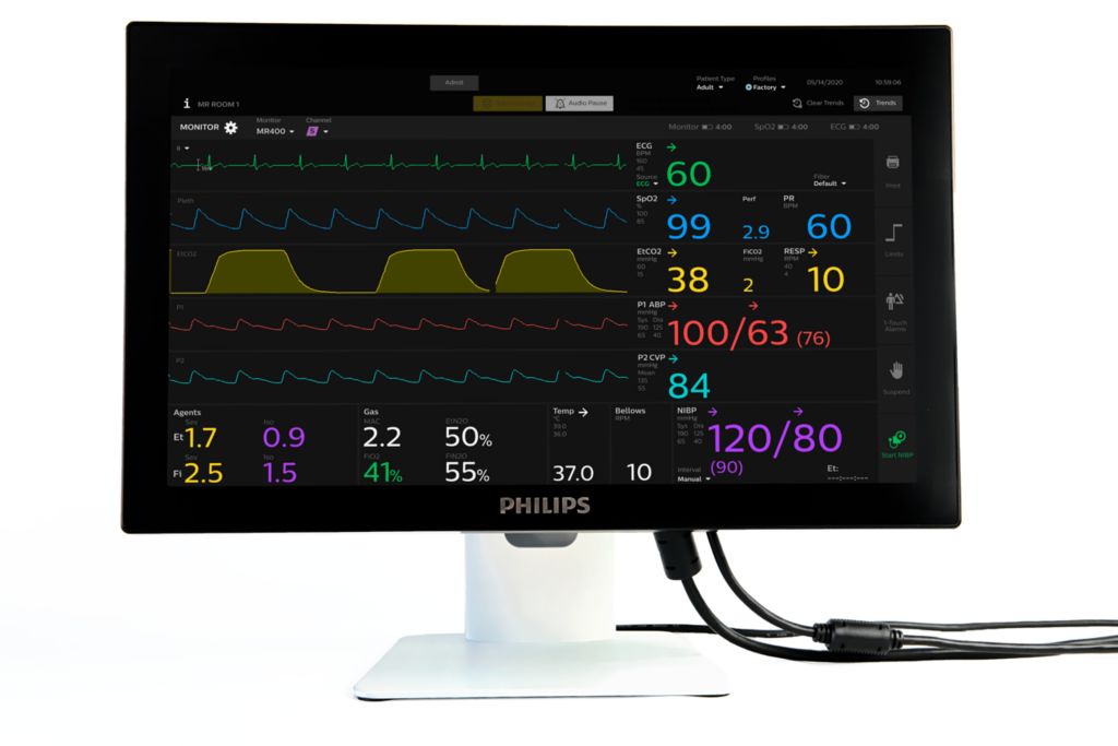 MR Patient Care Portal 5000 MRI 対応生体情報モニタ