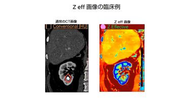 その３：仮想単色X線画像、実効原子番号表示、スペクトラルデータ生成について
