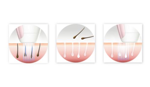 Nyd glat hud hver dag