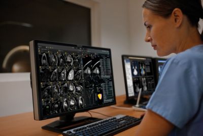 Radiology professional reviewing advanced visualization images on diagnostic workstation