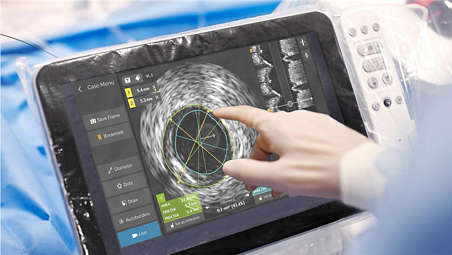 Philips ofrece la sencilla función plug-and-play del ultrasonido intravascular digital y de fisiología con control mediante una pantalla táctil desde el campo estéril para acceder a datos e información del paciente de forma más rápida.