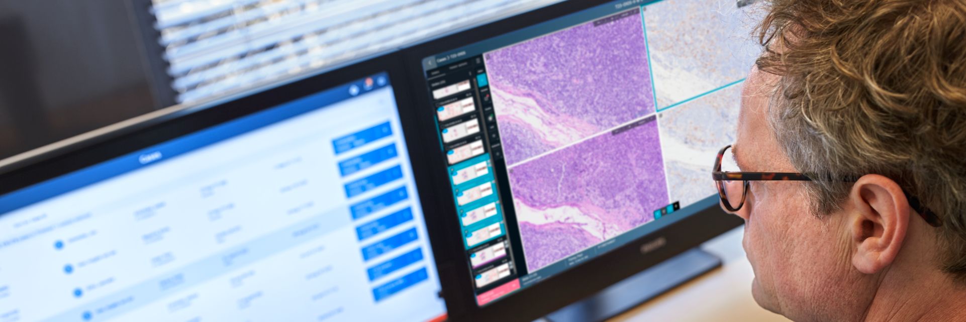 digital Pathology - Pathology Scanner SG series 