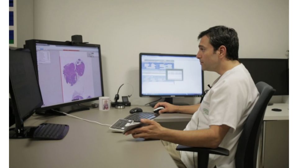 Pathologist reviewing digital pathology slides at a desktop monitor