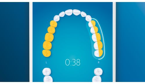 Bringt Sie zurück zu ausgelassenen Stellen für eine 100 %ige Abdeckung