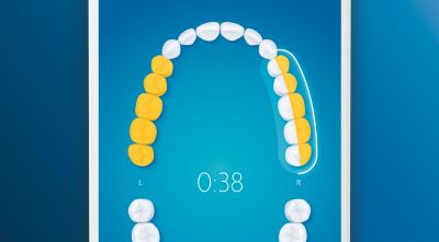 Vráti vás späť na všetky vynechané miesta, aby ste dosiahli 100 % vyčistenie zubov