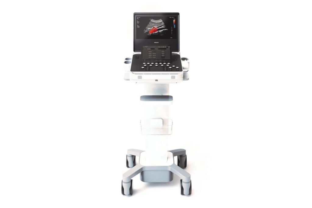 Premium compact ultrasound system