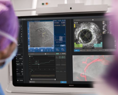 echocardiography epiq image