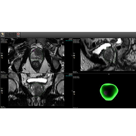 Boost confidence for biopsies