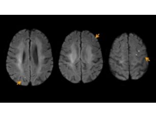 SmartSpeed Diffusion - Brain MR Clinical Applications