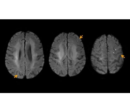 SmartSpeed Brain