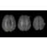 SmartSpeed Brain thumbnail