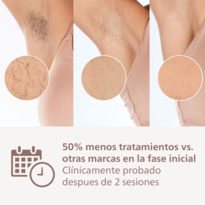 Philips Lumea IPL 9000 Series