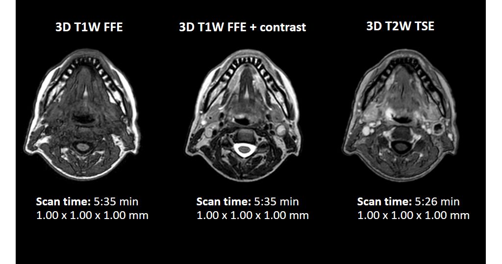 T1W and T2W contrasts – head and neck