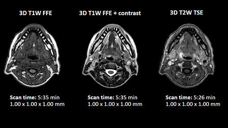 T1W and T2W contrasts – head and neck