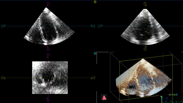 TomTec 4D Cardio-View