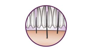 Visokozmogljivi diski nežno odstranjujejo tudi najtanjše dlačice