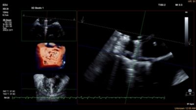 Philips - EPIQ CVx Premium Cardiology Ultrasound System