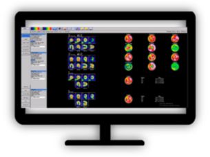 NM Corridor4DM 2023​ SPECT and PET cardiovascular quantification, review, and reporting