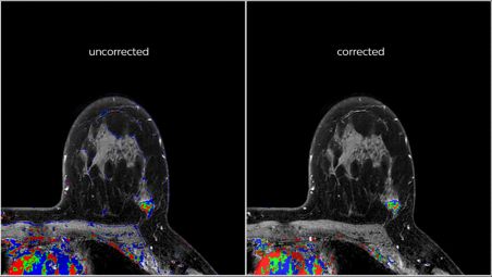 Des images plus nettes pour des examens plus productifs