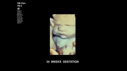 Fetal face at 34 weeks gestation.