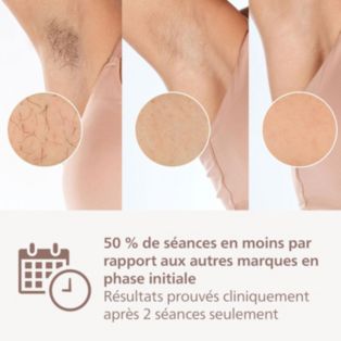 Lumea IPL 8000 Series Épilateur à lumière pulsée avec SenseIQ