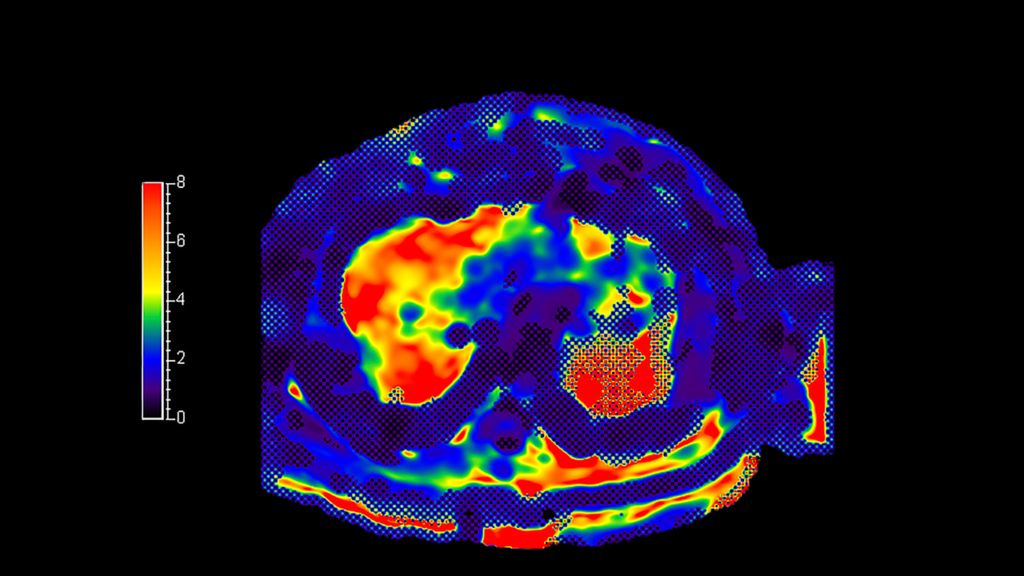 MR Elastography Extension 2D SE-EPI