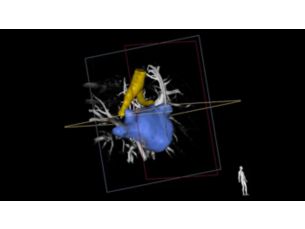 EP navigator Catheter navigation tool for EP procedures