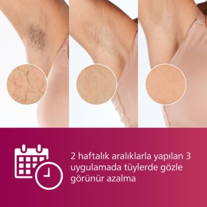 Philips Lumea IPL 7000 Series