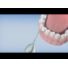 Philips AirFloss – Die einfache Art der Zahnzwischenraumreinigung