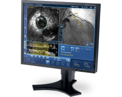 TriReg Monitor