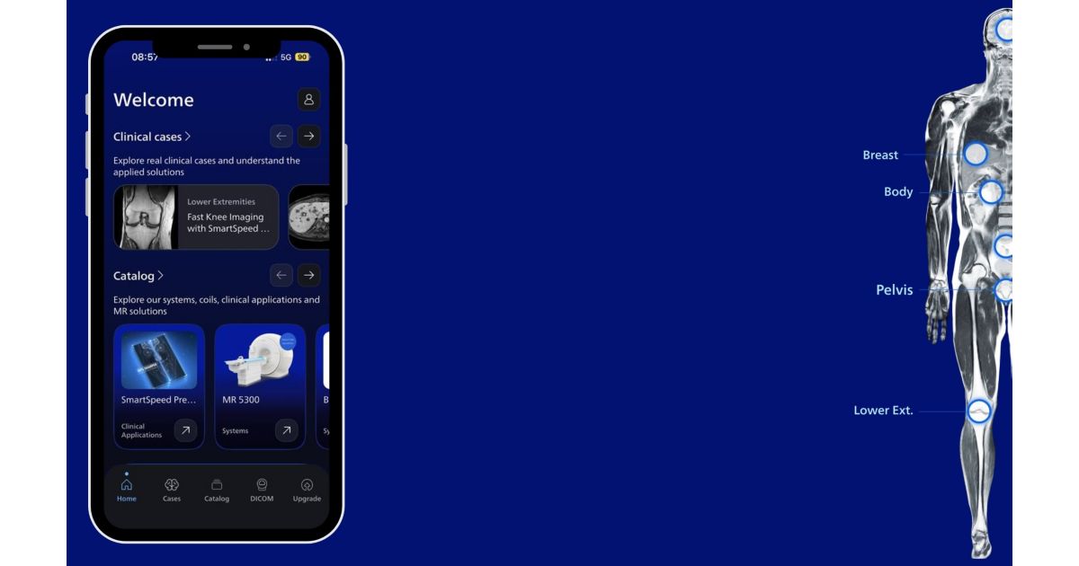 MRI Imaging app - Philips