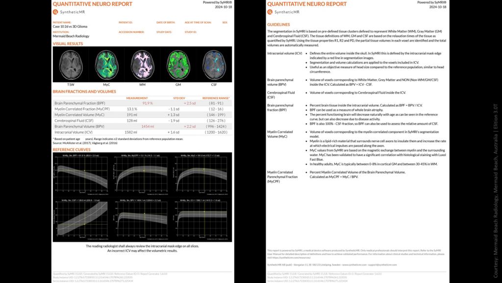 Quantitative neuro report