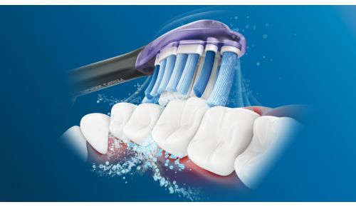 Philips Sonicare's advanced sonic technology