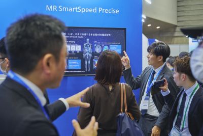 SmartSpeed