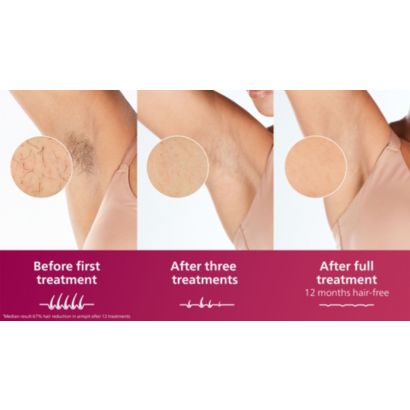 Philips Lumea IPL 7000 Series