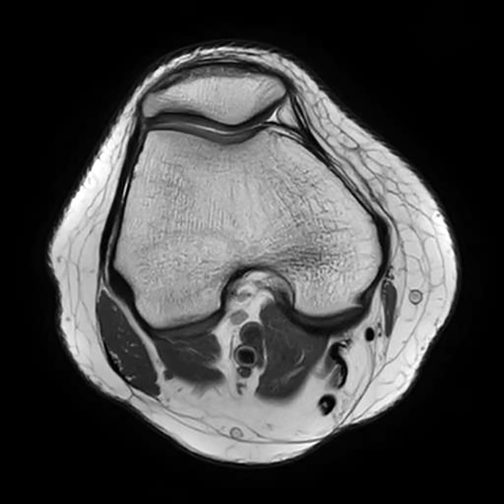 PDW mDIXON XD TSE IP