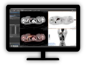 NM Mirada XD4.2 PET/CT and NM viewing and quantification