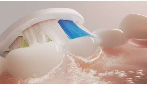 Dokumenteret Sonicare-teknologi