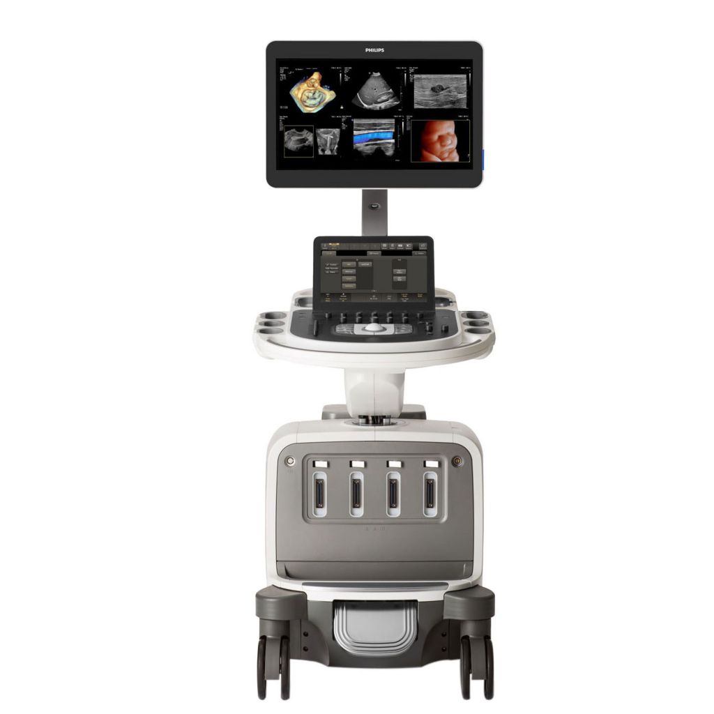 Philips EPIQ Elite Ultrasound System.