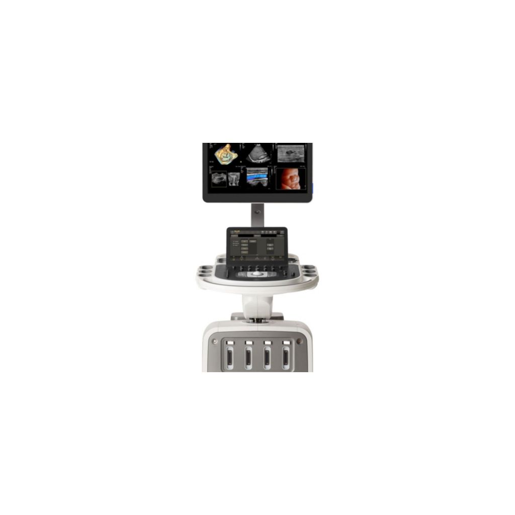 Philips EPIQ Elite Ultrasound System.
