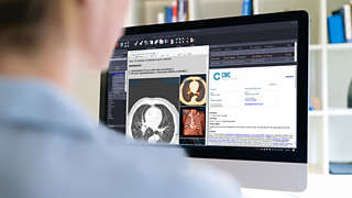 Significantly reduce your reporting time while increasing the value of your radiology report with Philips interactive multimedia reporting