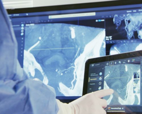 SmartCT SoftTissue