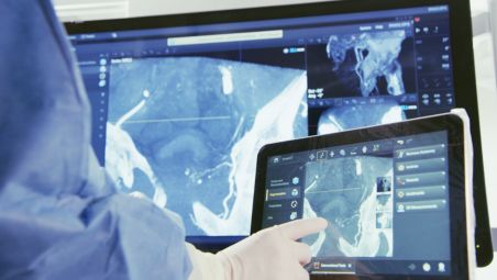 Interact with your CBCT image at tableside