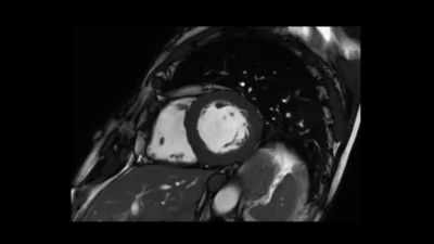 Philips - SmartSpeed Precise - Cardiac NMRF445D MR clinical ...
