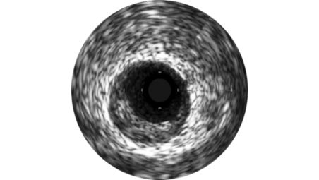 Grayscale enhances angiography procedures by enabling detailed views.