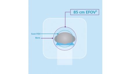 Visual full anatomy with 85 cm EFOV [5]