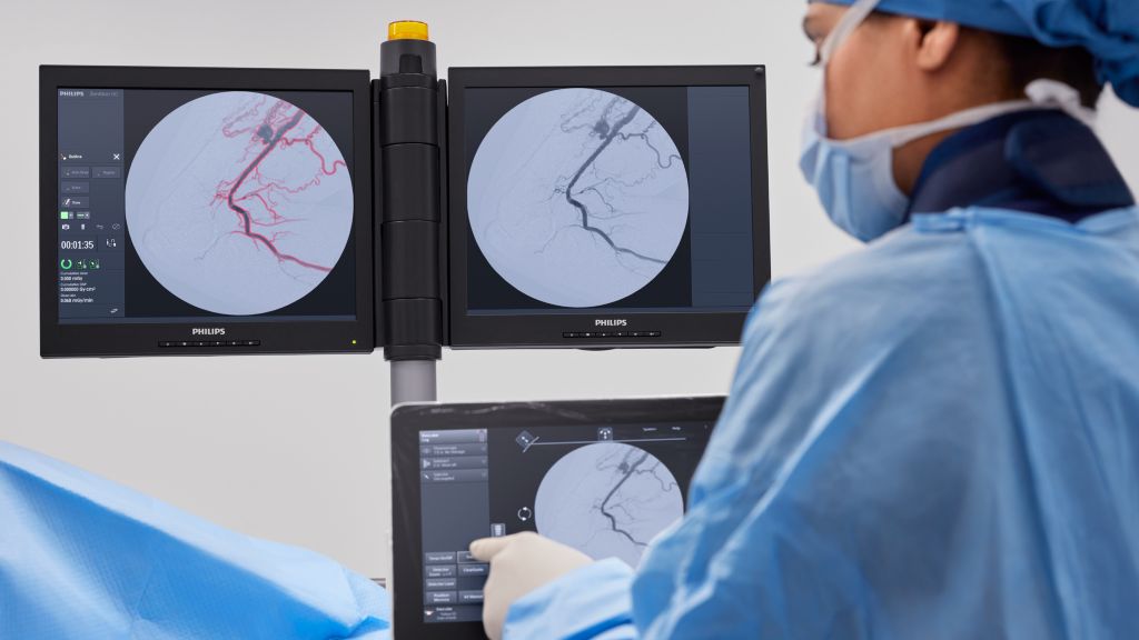 Automatic Vascular Outlining