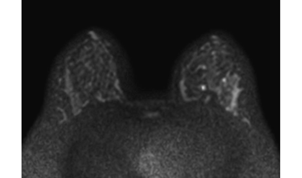 Diffusion (b800)