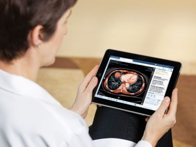 Clinician accessing medical images on tablet using Philips Vue Motion viewer