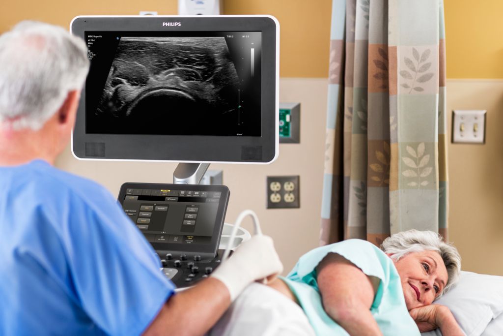 Ultrasound MSK Hip Scan with eL18-4 Transducer